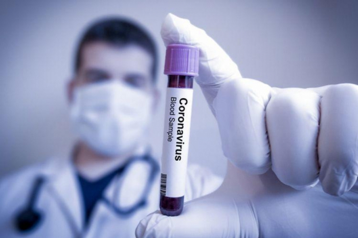   Weitere 491 Menschen in Aserbaidschan mit Coronavirus infiziert -   6 Tote    