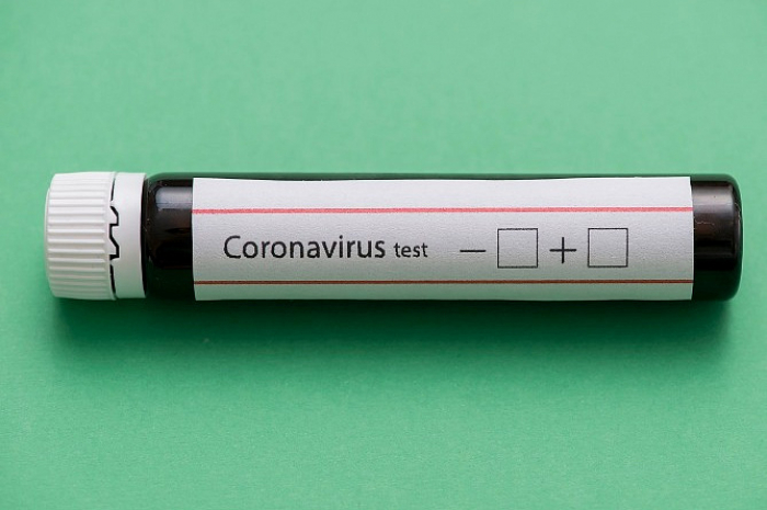Koronavirusu 30 dəqiqəyə aşkar edən test hazırlandı 