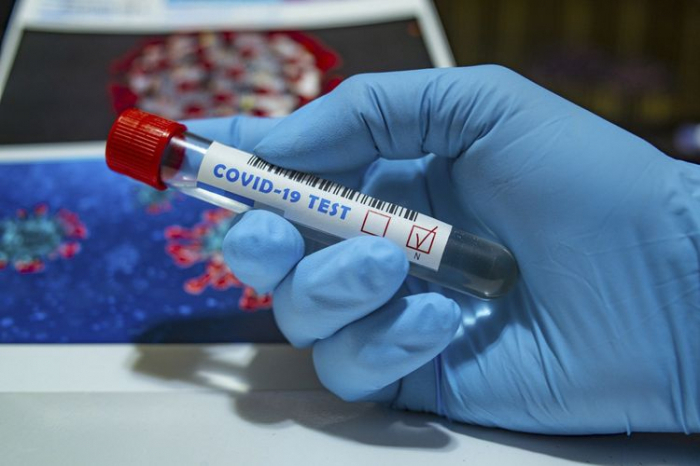 İndiyədək 700 mindən çox koronavirus testi aparılıb