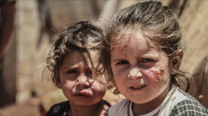 Enfermedad de leishmaniasis se propaga en los campos de refugiados en Idlib, Siria