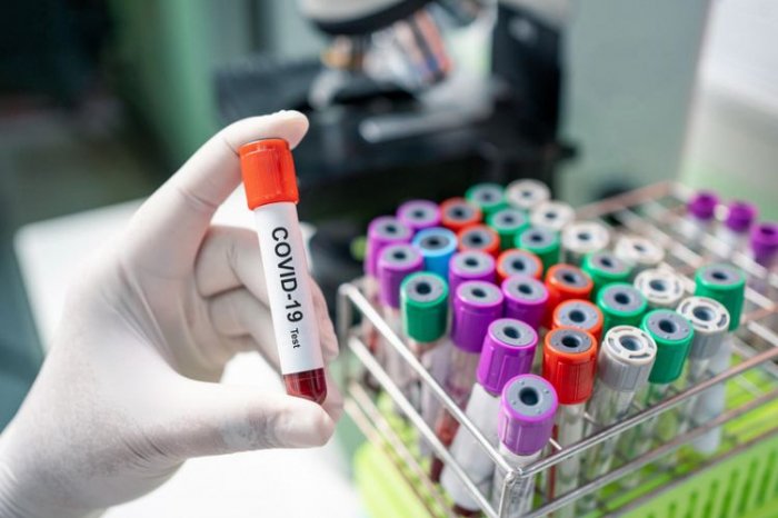 La barre des 2000 morts du coronavirus franchie en Argentine