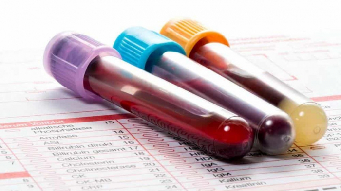 Un test sanguin révolutionnaire dans la détection des cancers?