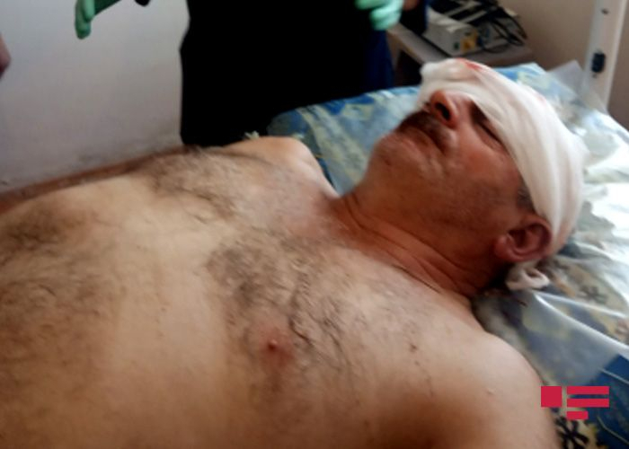   Ein von Armeniern verwundeter Zivilist wurde ins Krankenhaus eingeliefert  