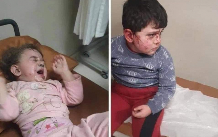  Armenischer Terror gegen aserbaidschanische Kinder  - FOTOS  