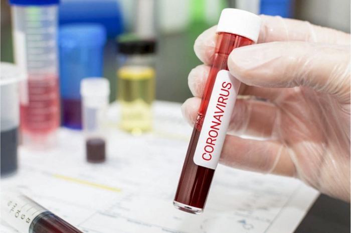 Rusiyada daha 450 nəfər koronavirusdan öldü
