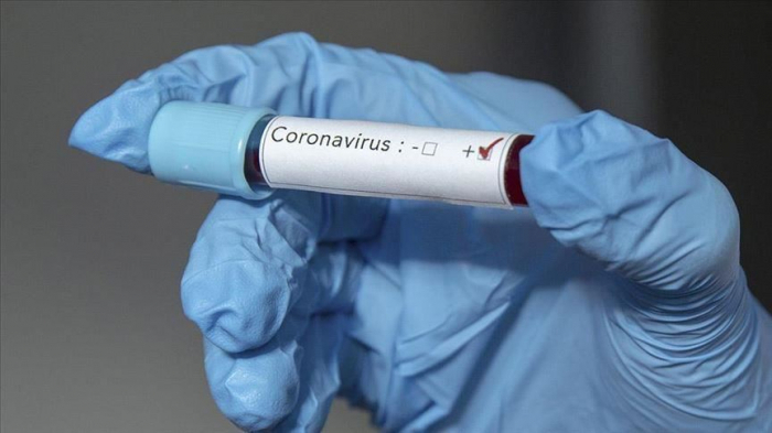 Dünyada koronavirusla bağlı son vəziyyət  
