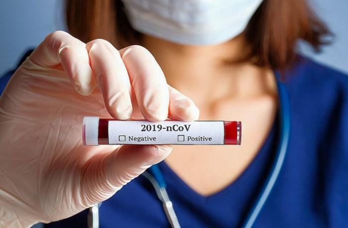   Azerbaijan records 1,101 new COVID-19 cases, over 4,200 recoveries  