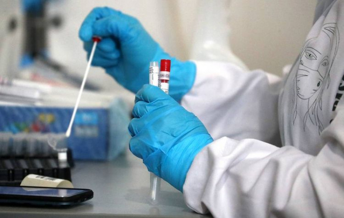 Rusiyada koronavirusdan daha 446 nəfər ölüb