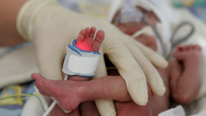 Weniger Kuscheln - WHO sieht Frühchen in Gefahr