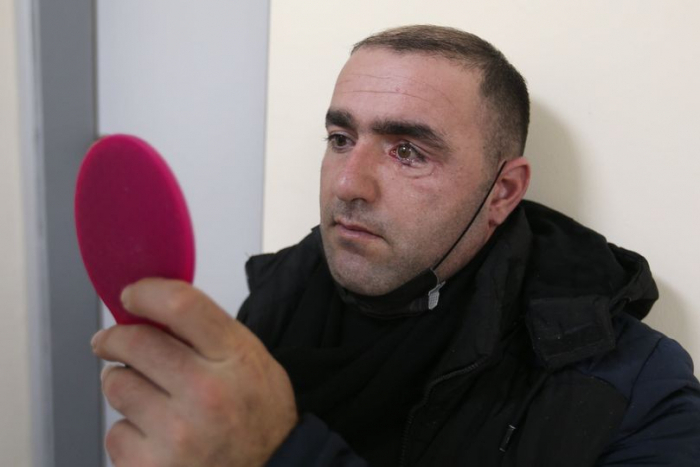  Un vétéran azerbaïdjanais reçoit une prothèse oculaire importée d