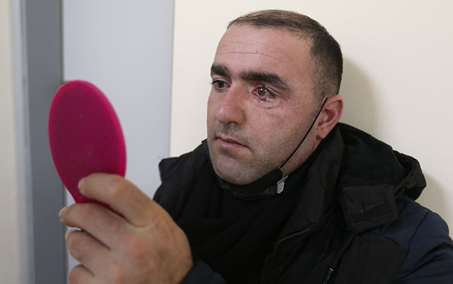   Protez göz köçürülən qazi:  “İndi özümü yaxşı hiss edirəm” -  VİDEO  
