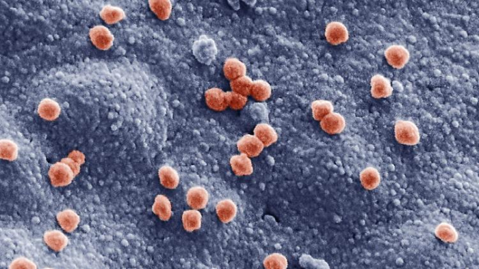   Viruslast und Gewebeschäden hängen zusammen  