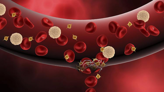   Forscher kommen Blutgerinnseln auf die Spur  