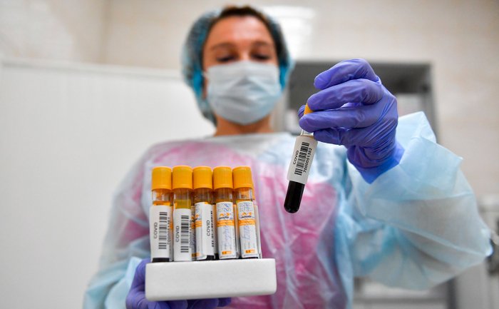  İndiyədək nə qədər koronavirus testi aparılıb?  