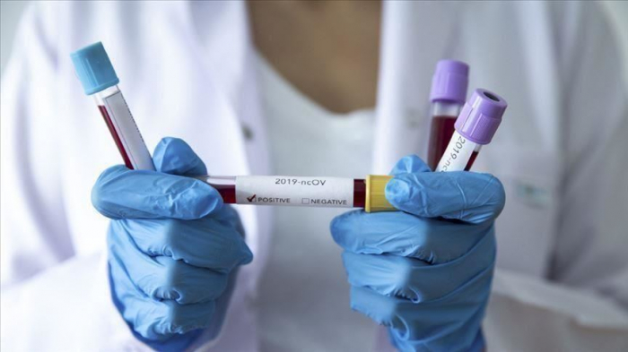  Azerbaijan reports 60 new coronavirus cases, 148 recoveries 
