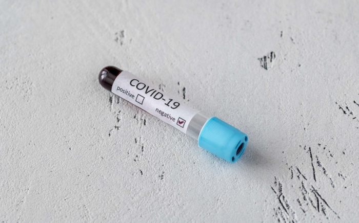 Coronavirus: 3 069 nouveaux cas confirmés en une journée en Azerbaïdjan