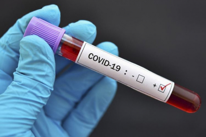   Azerbaijan records over 1,700 coronavirus cases in a day  