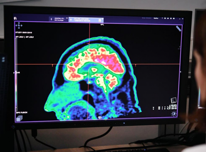 Scientists use AI to create drug regime for rare form of brain cancer in children