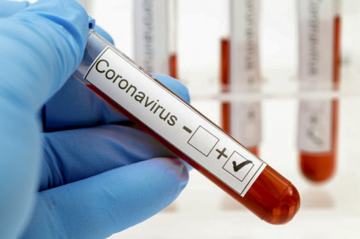  Coronavirus: 2 676 nouveaux cas confirmés en Azerbaïdjan en une journée 