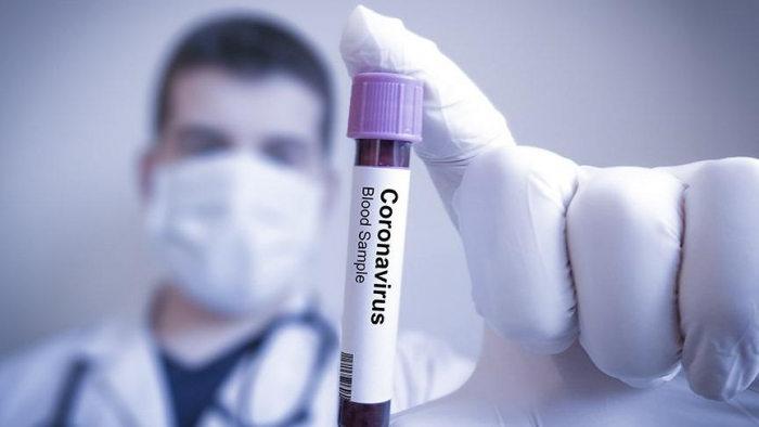   Azerbaijan records 1,850 more coronavirus cases  