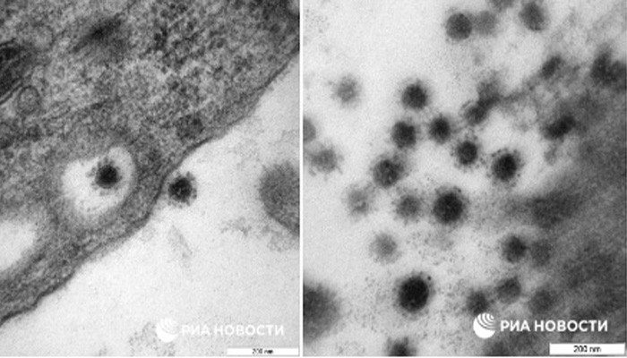 Une image rare de la souche Delta du coronavirus a été publiée