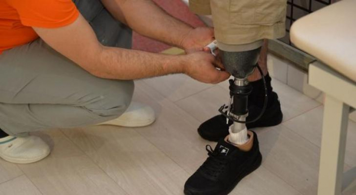   Azerbaijan provides 160 war veterans with latest generation of prostheses  