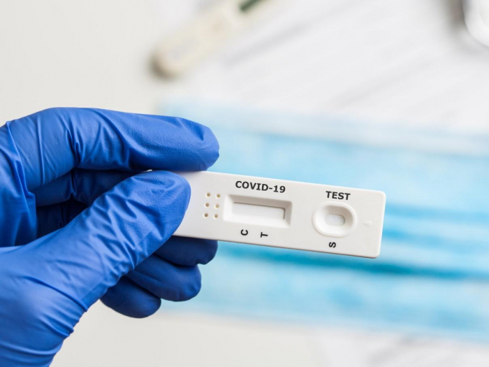   Azerbaijan produces over 20,000 COVID-19 PCR tests   