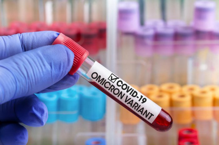    “Omikron” Azərbaycanda sürətlə yayılır-    RƏSMİ      