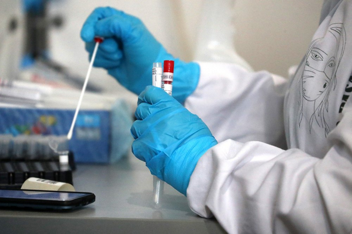   أذربيجان:  1068 إصابة بكورونا وتطعيم 8471 جرعة من لقاح كورونا في 21 يناير 