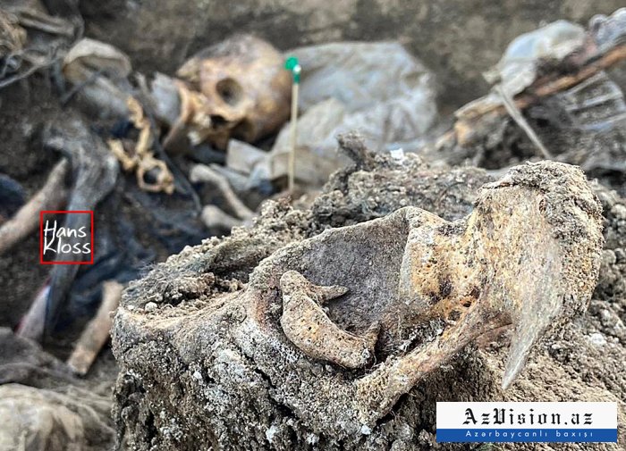   Los armenios los torturaron hasta la muerte y los enterraron juntos -   FOTOS     