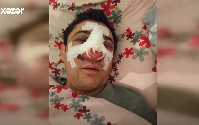    Bakıda avtobus sürücüsü döyüldü    - VİDEO     
   