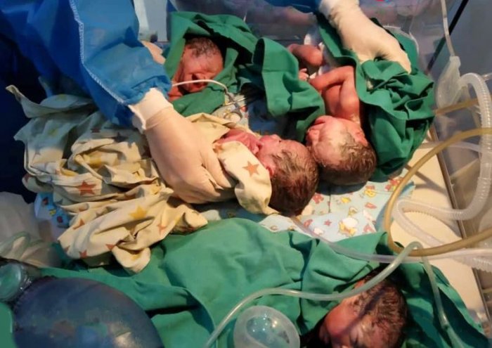  Koronavirusa yoluxan hamilələrdən biri üçəm, digəri dördəm dünyaya gətirdi -    FOTO        
