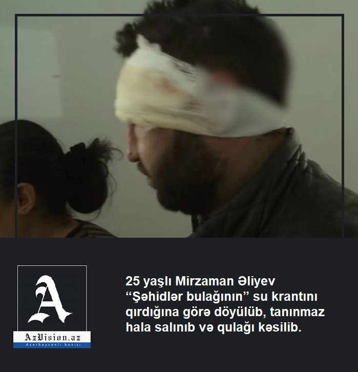    “Şəhidlər bulağının” krantını qıran oğlanın   qulağını kəsdilər - FOTO+ VİDEO      