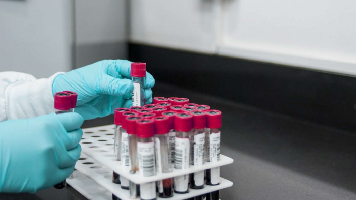 Une étude affirme que des microplastiques ont été trouvés dans du sang humain pour la première fois