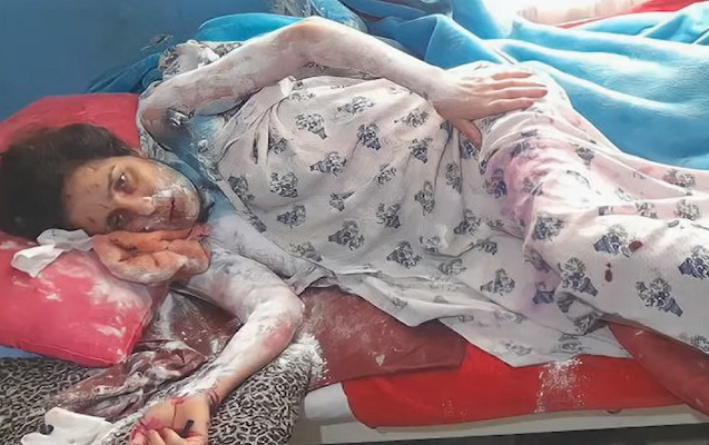   Azərbaycanda qayınata gəlininin üzünə “kislota” töküb -  VİDEO  