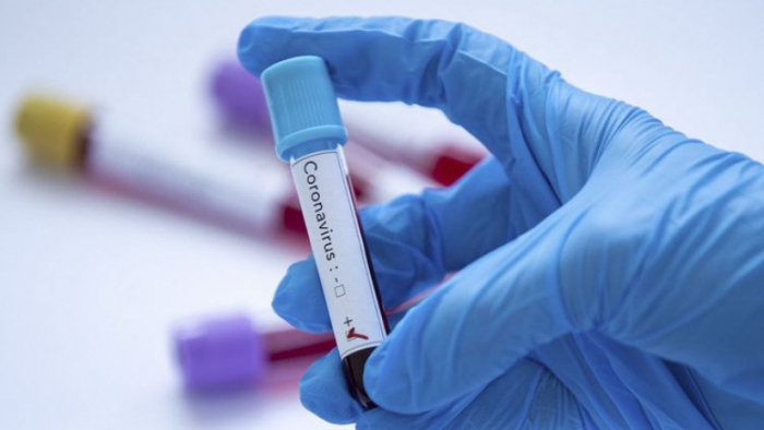   Azerbaijan records five daily coronavirus infections   