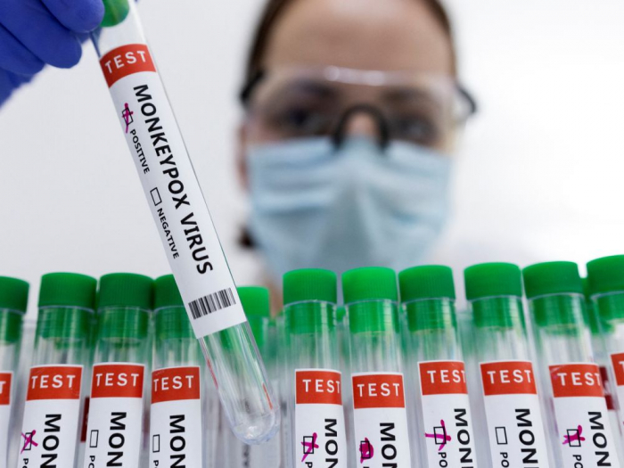 La France confirme trois cas de variole du singe, indique SPF 