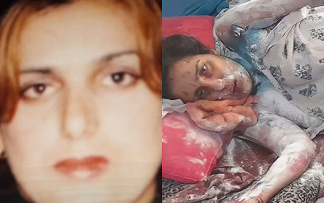    Qayınatası üzünə “kislota” tökən qadın öldü -    Video      
