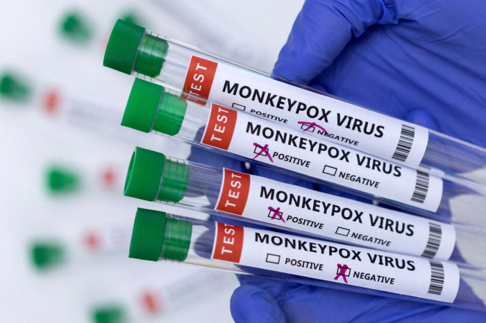   Georgia confirms first monkeypox case   