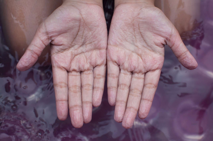   The surprising benefits of fingers that wrinkle in water -   iWONDER    