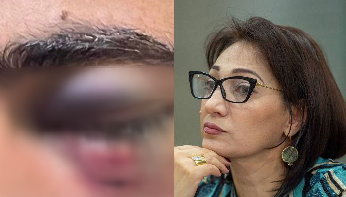    Erməni deputat polislərin aksiyadakı "əl işi"ni yaydı    