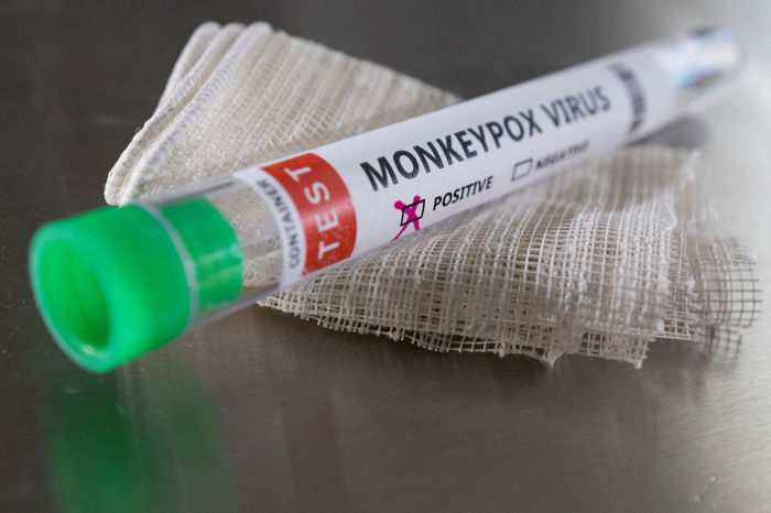   U.S. monkeypox cases jump 33% in 3 days  