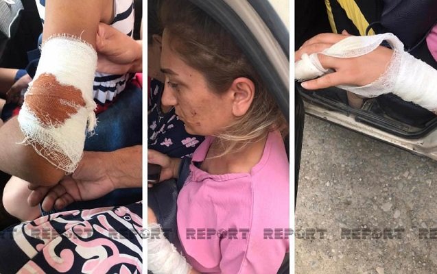    Bərdədə kişi arvadının evini yandırdı, azyaşlı qızını bıçaqladı -    Fotolar     
   