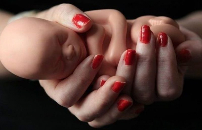 Azərbaycan selektiv abortlara görə dünyada birinci yerdədir