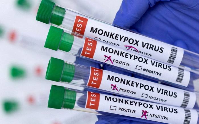   TABIB reveals methods of protection against monkeypox   