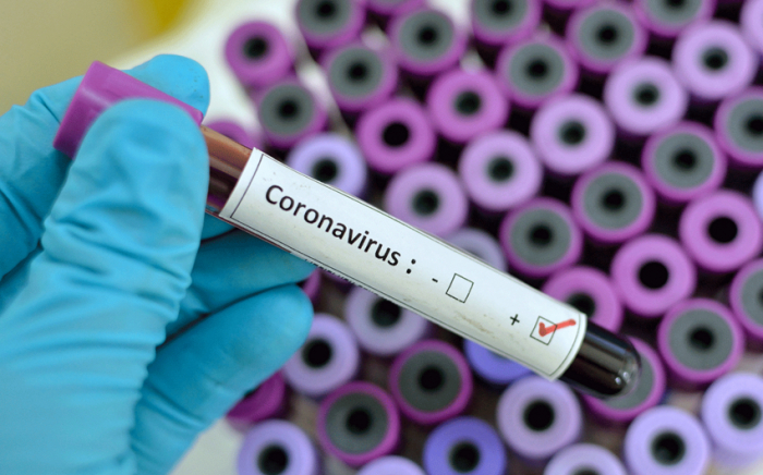  Am letzten Tag wurden in Aserbaidschan 164 Menschen mit Coronavirus infiziert und 3 Menschen starben  