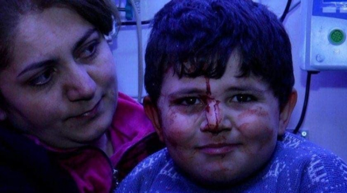 Qan içində təbəssüm, yaxud, düşməni sındıran uşaq