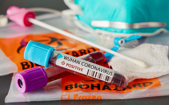  Am letzten Tag wurden 60 Menschen mit Coronavirus infiziert und 4 Menschen starben 