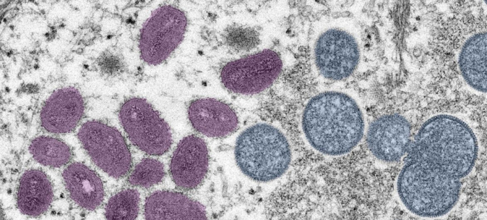 WHO renames monkeypox as "mpox" to avoid stigma