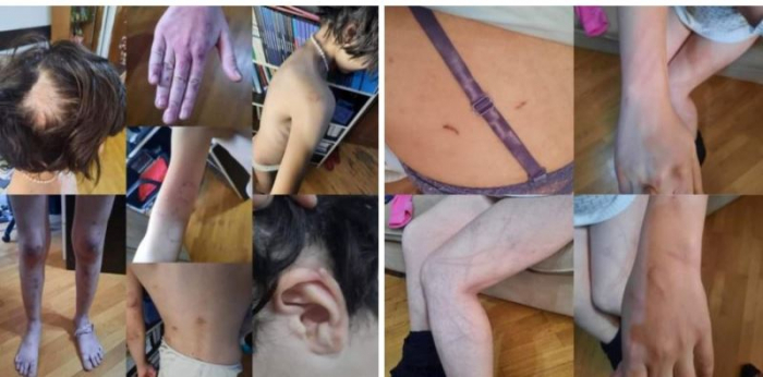    Masalıda kişi hamilə qadını və qızını döyüb,  günlərlə evdə dustaq etdi    